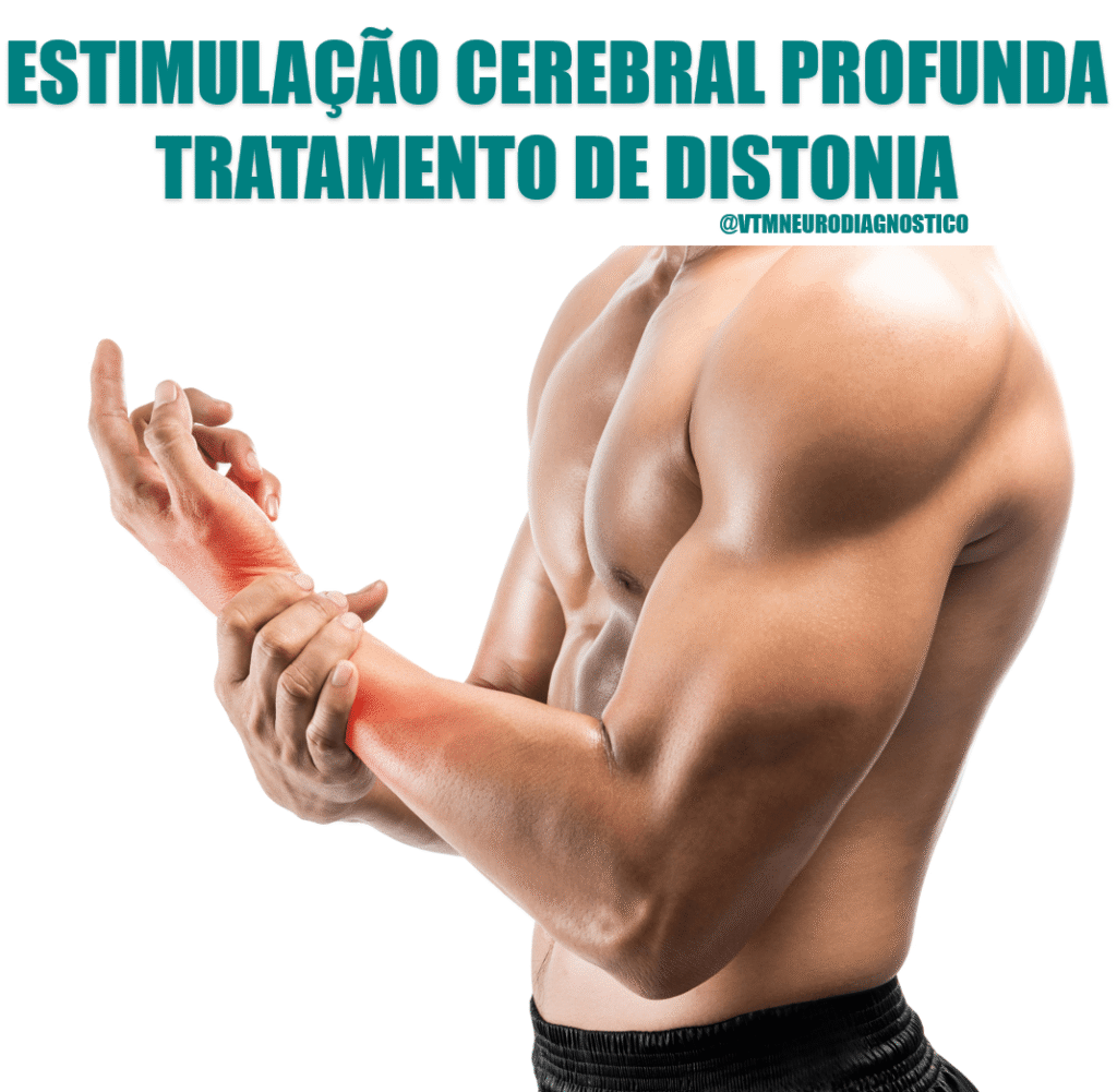 tratamento distonia