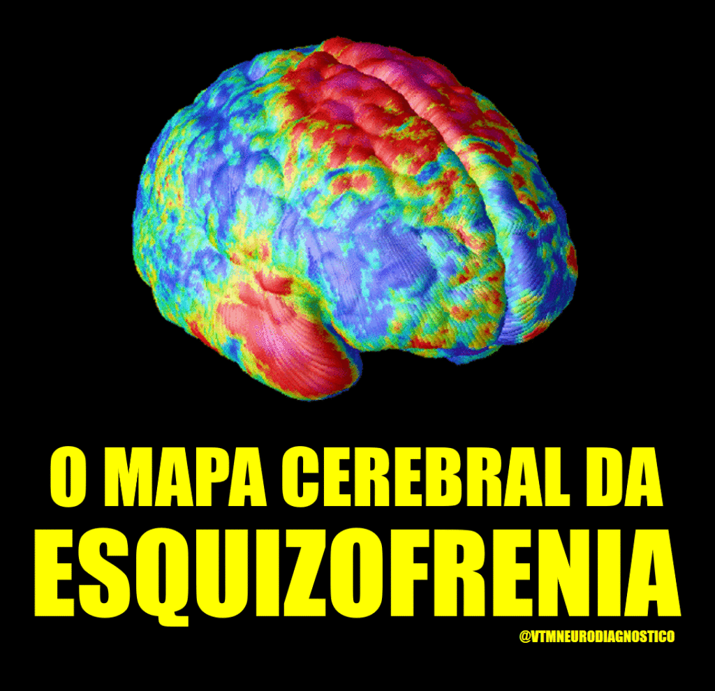 Detecção Precoce da Esquizofrenia através do Mapeamento Cerebral. VTM Neurodiagnóstico: Diagnóstico e Tratamento em Neurologia e Saúde Mental.